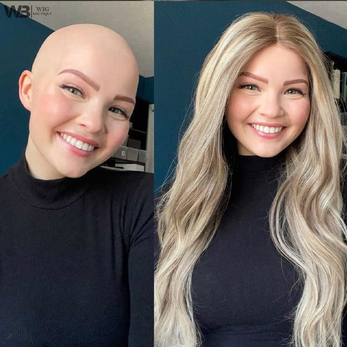 medical-grade-human-hair-wigs-for-cancer-patients-delhi