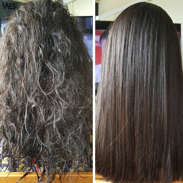 Hair Density Correction Services