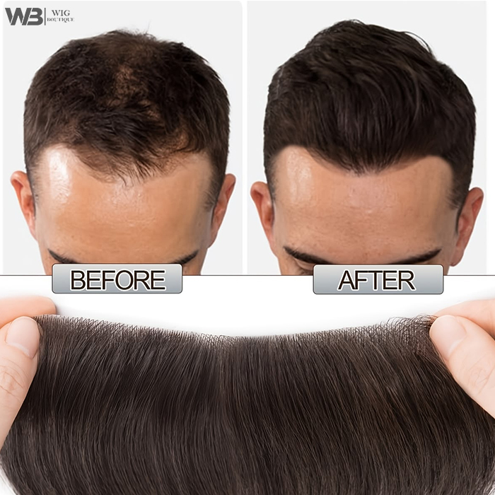 Hair Density Correction Services