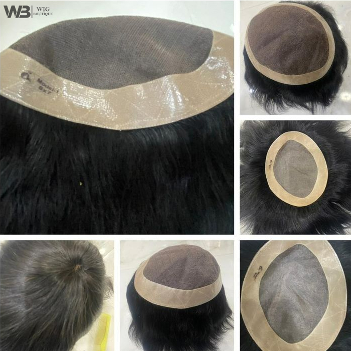 Hair Density Correction Services