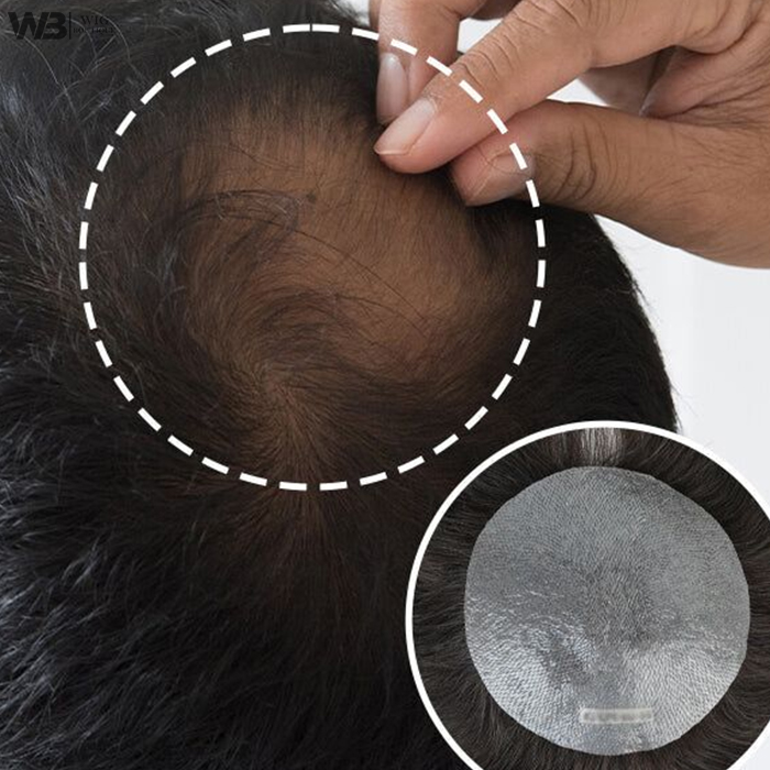 Hair Density Correction Services