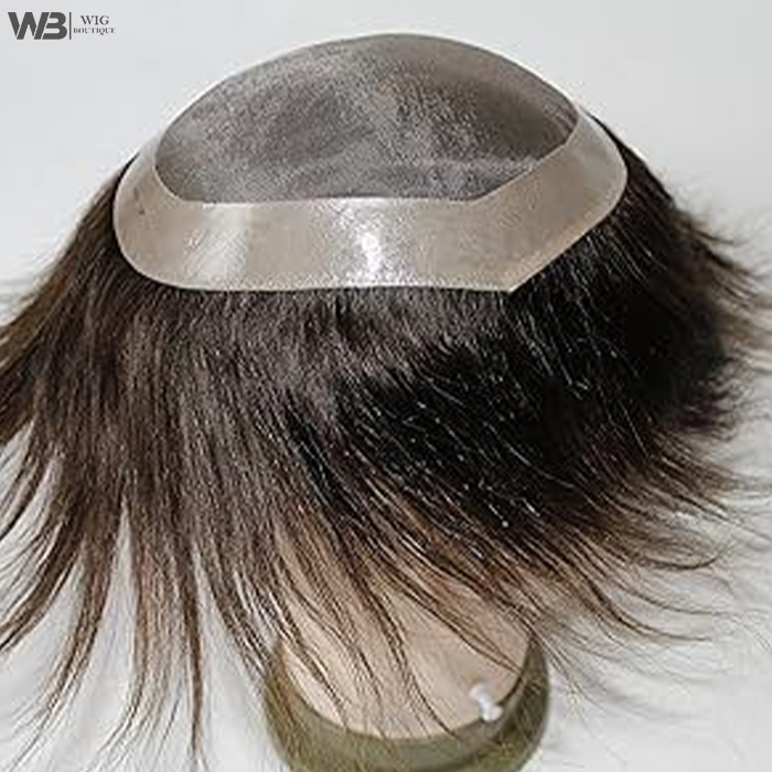 Hair Density Correction Services