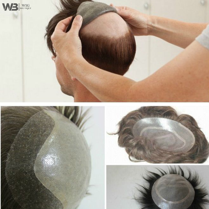 Non-Surgical Hair Replacement Solutions