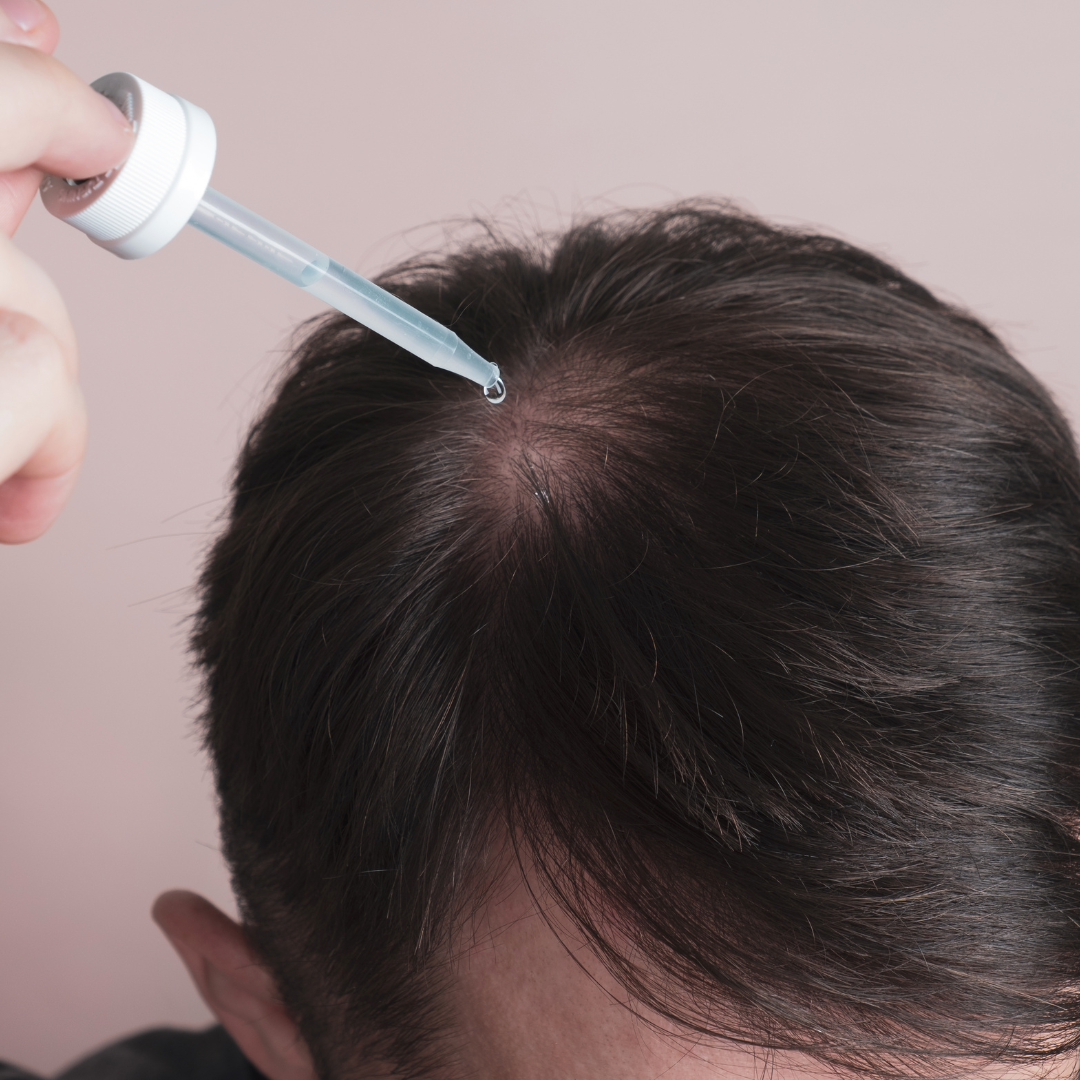 Hair Loss & Scalp Treatments