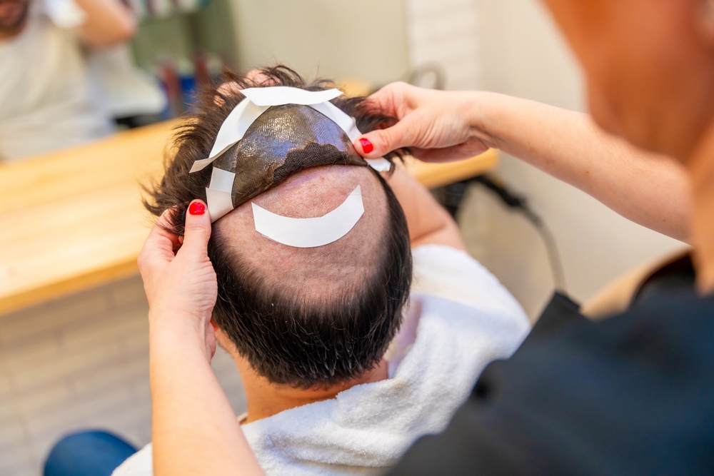 Best-hair-replacement-service